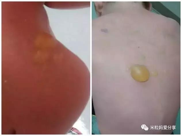                     这件小事不注意，孩子患癌的几率会翻倍！