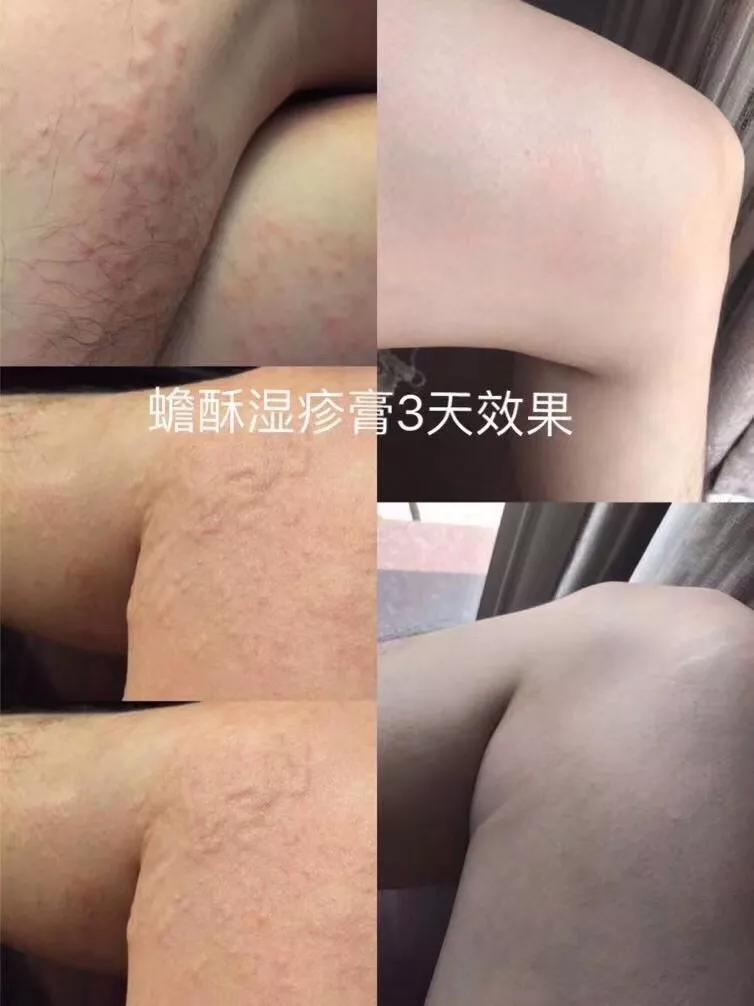 【明星爆品】沁园春婴儿呵护膏