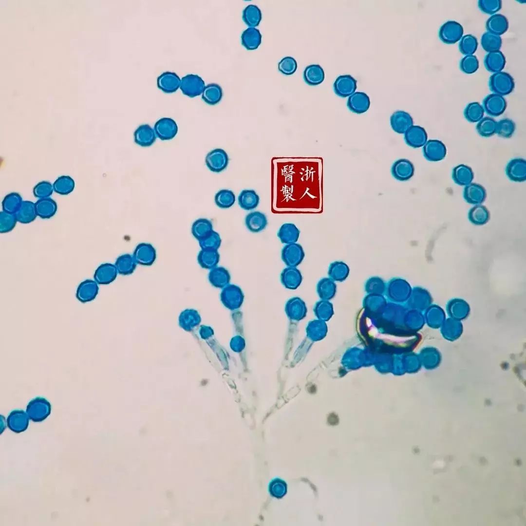 显微镜下的真菌图片-图库-五毛网