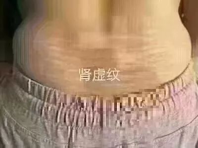 04d119fff3694acb9afacd502391ce6c.jpeg