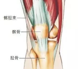 识别方法 疼痛局限于髂胫束在膝盖外侧的部位;膝盖的其余部位可能无