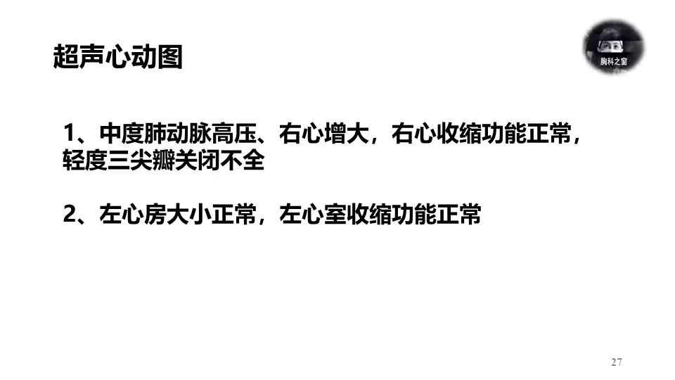 d1ce756cc458477abb229a84a4995434.jpeg