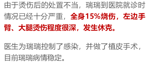                    嘶！连皮一起撕下来！滚烫开水泼3岁娃一身，爷爷急了硬脱衣...