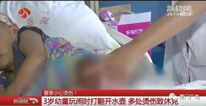                     嘶！连皮一起撕下来！滚烫开水泼3岁娃一身，爷爷急了硬脱衣...