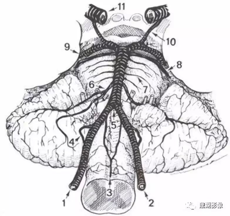 椎基底动脉系统及其分支解剖(前后位)