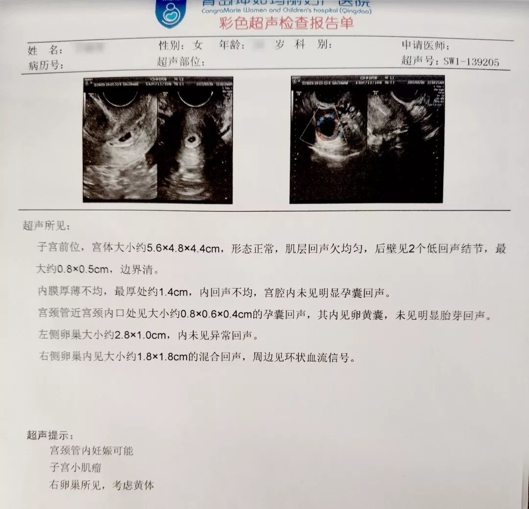 喜怀孕却赶上万分之一几率的宫颈妊娠20分钟手术成功解除凶险危机
