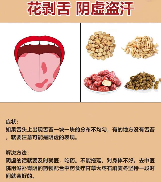 如果舌头上出现舌苔一块一块的分布不均匀,有的地方没有舌苔,就要注意