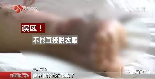                     嘶！连皮一起撕下来！滚烫开水泼3岁娃一身，爷爷急了硬脱衣...