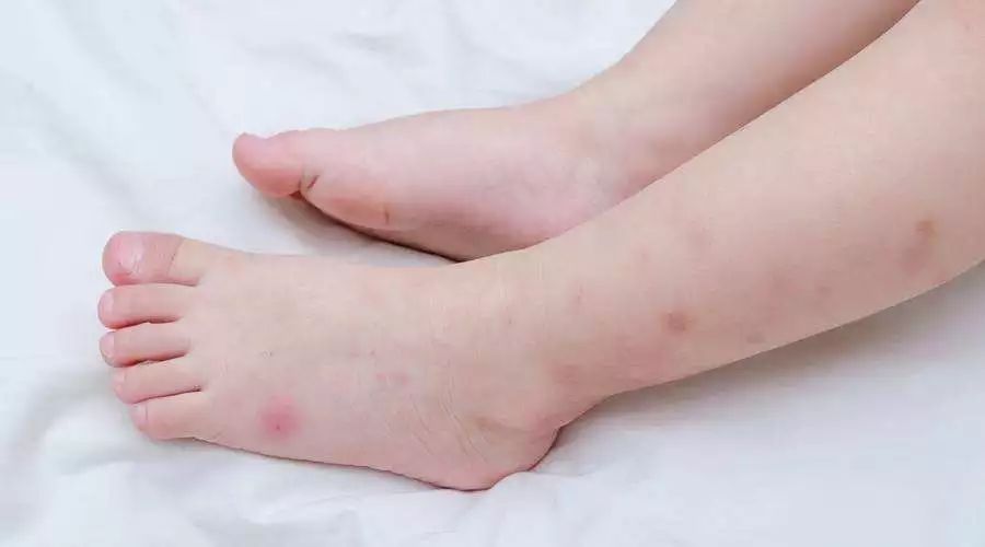                     【嘻哈优选】夏季防蚊就靠它，孩子野外活动再无忧。