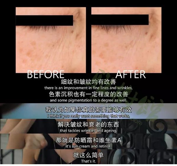 用这支世界上最有效的抗老成分做成的精华,3周让你细纹消失,粗糙毛孔变光滑! www.v118.com 用这支世界上最有效的抗老成分做成的精华,3周让你细纹消失,粗糙毛孔变光滑! v118.com