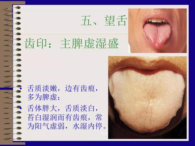 c953eb245a504a31a5d841f2819a4552.jpeg