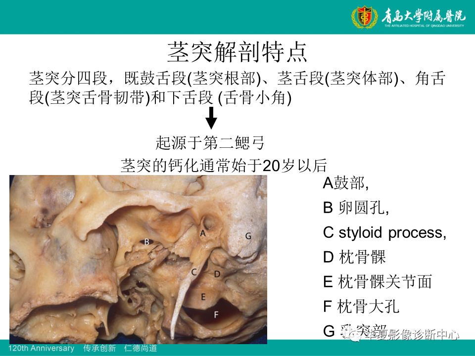 茎突综合征