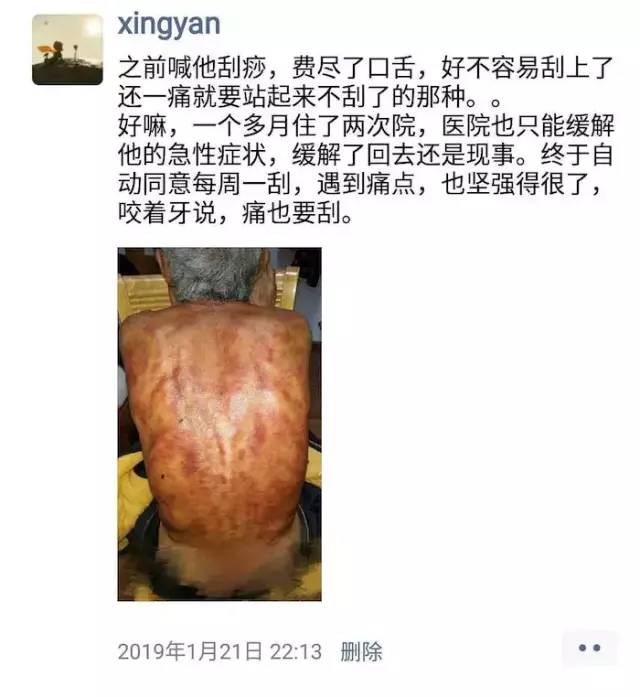 肺气肿-李道政虎符铜砭辨证配穴案例解析