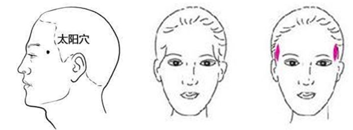 (太阳穴位置示意图)而常说的“三庭五眼”黄金标准中,“五眼”中的两