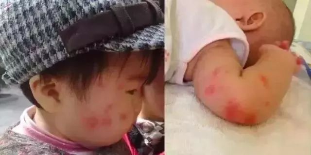                    驱蚊水终于选对了！ 4小时长效驱蚊，孕妇宝宝都能用！