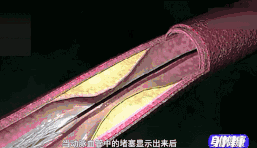2e410433da3c470c94f0f3443e483f53.gif