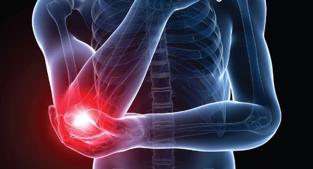 什么叫做无菌性的炎症 342220ba3a0a43b7877a7152e25a1d78.jpeg