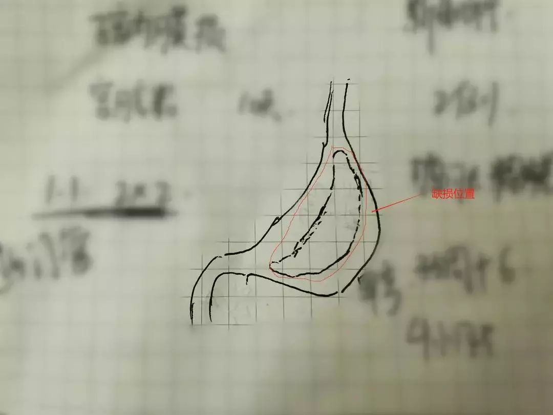 刚腹什么成语_成语故事图片(3)