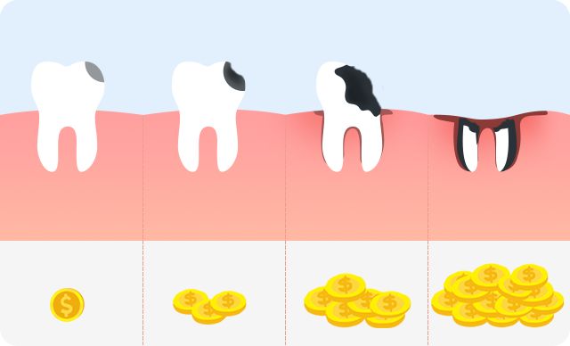 完全不懂,各种补牙材料,到底怎么选?