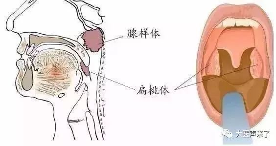 打呼不是睡得香记忆力差爱发脾气颜值降低可能都跟它有关