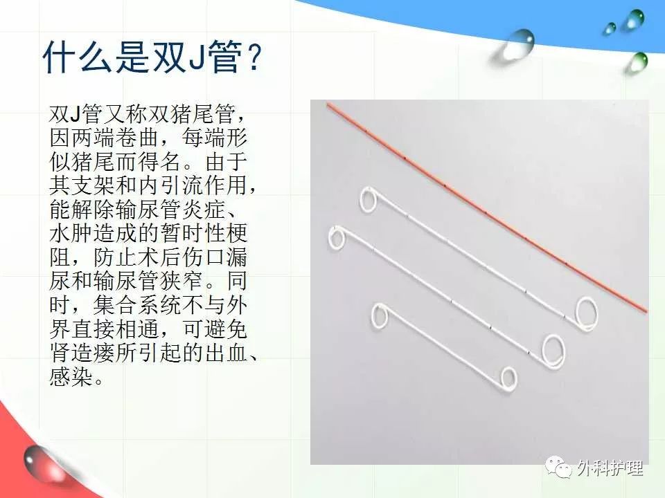 【ppt】泌尿外科留置双j管的健康指导