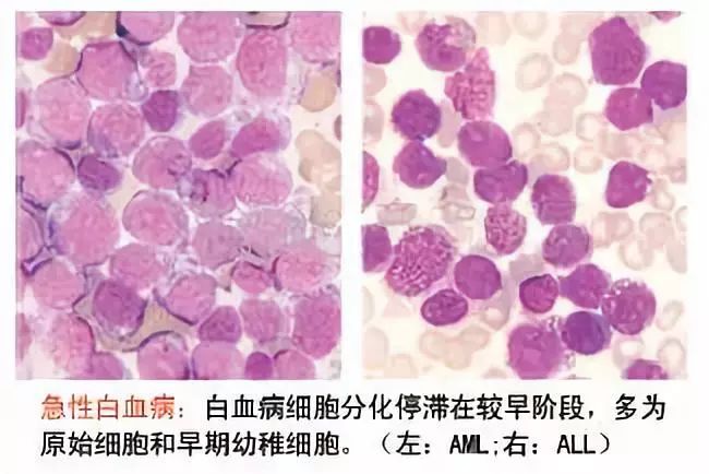                     多款乳制饮料被爆含肉毒杆菌，可致白血病？以后还能让孩子喝乳制饮料吗？