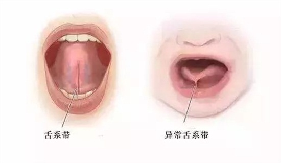                     2岁宝宝不会说话，原来都是吃粥惹的祸！