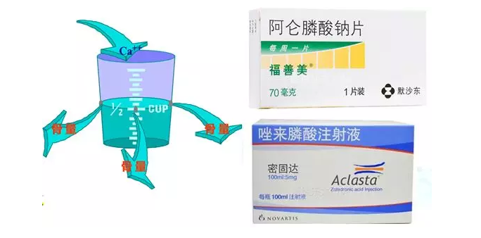 一半以上65歲以上女人患骨質(zhì)疏松癥，預防要注意這兩方面 