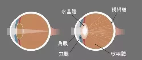 我国失明人口的统计_眼睛失明图片(3)