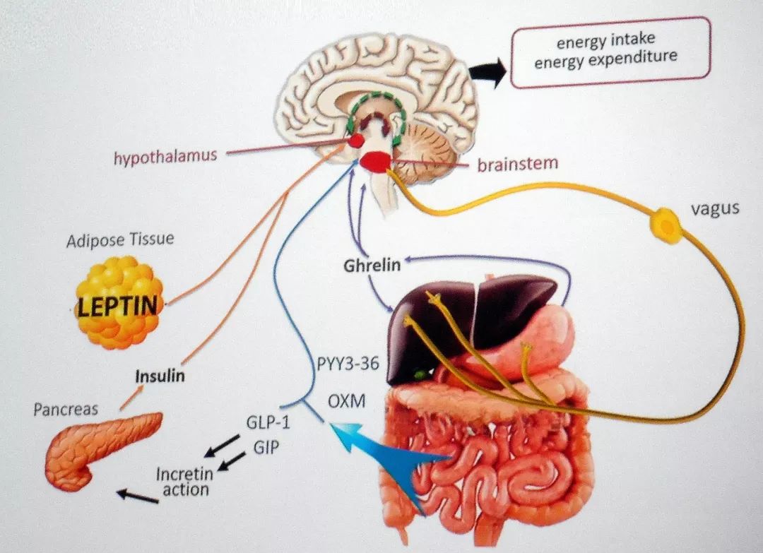 遗传学研究表明,重度肥胖是因参与食欲调节的下丘脑回路遭到破坏而