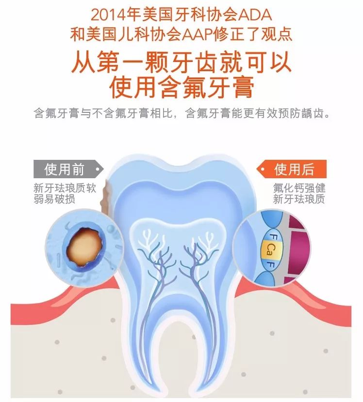                     安全、温和、防蛀效果好，德国儿医推荐0-6岁宝宝必入