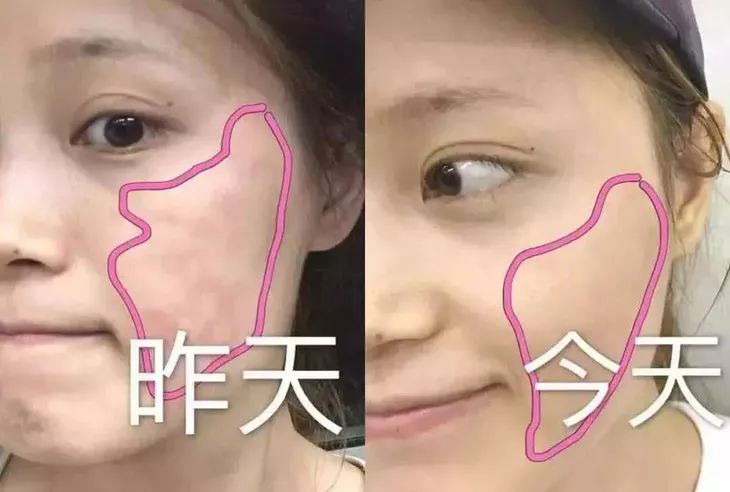 晒伤之后怎么白回来 a15398b225f74ceaaf0370f26f677dee.jpeg