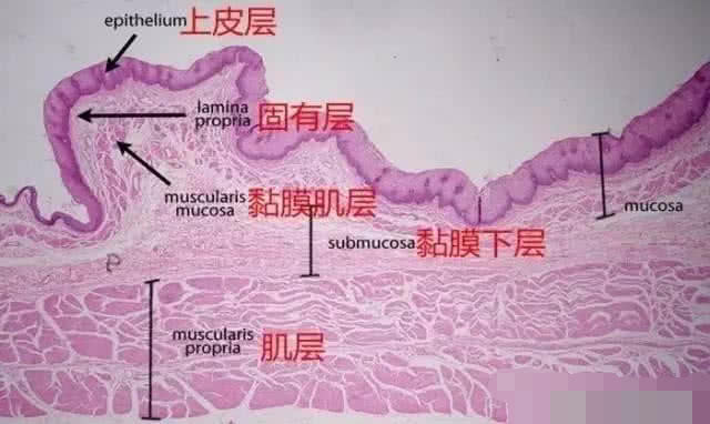 食管胃粘膜异位怎么办