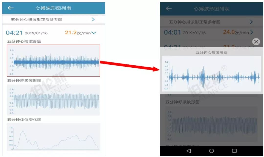 正常及异常心律及心跳频率,均可以每5分钟为一段,查看实时波形数据.