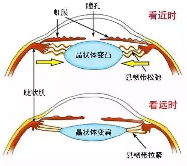 家长要知道孩子的近视与散光