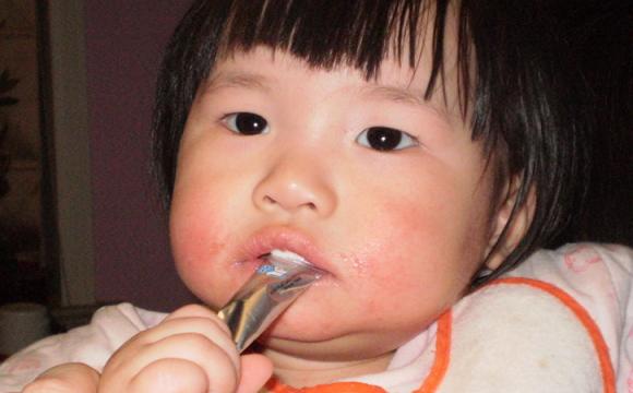                     儿科医生：娃生内热，上火还积食？夏季调理掌握3点，娃少生病