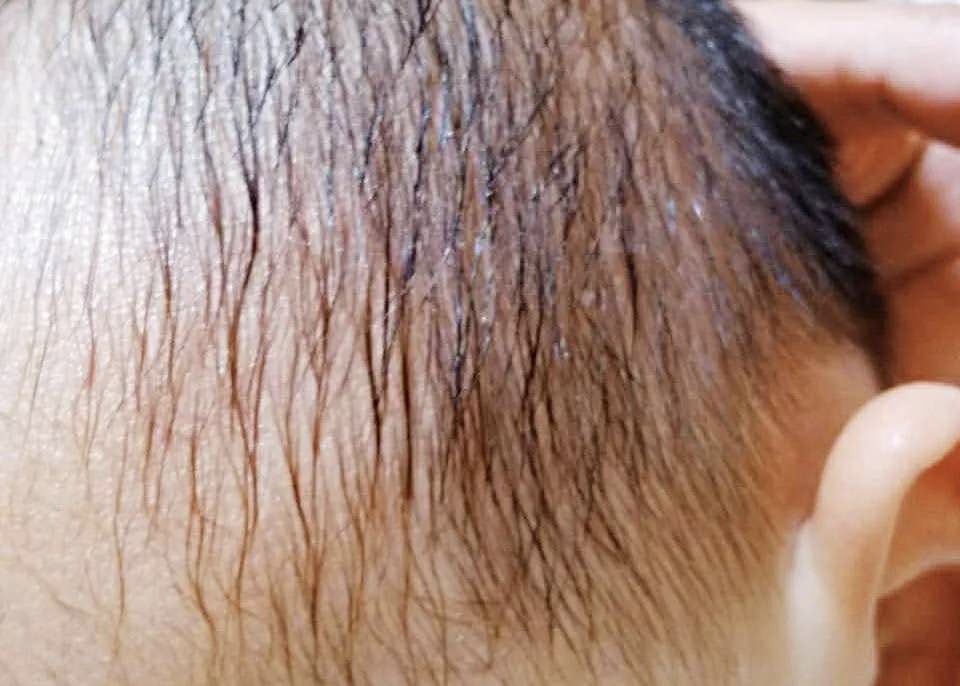                     宝宝爱出汗，是缺钙还是体虚？绝大多数宝宝是这个原因…