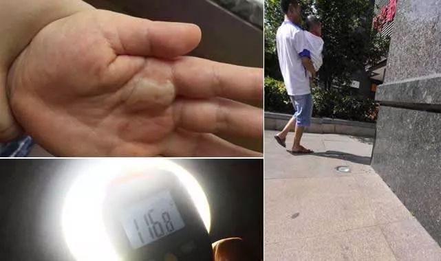                     宝宝玩滑梯成二度烫伤 小区附近这5个地方一定要警惕！