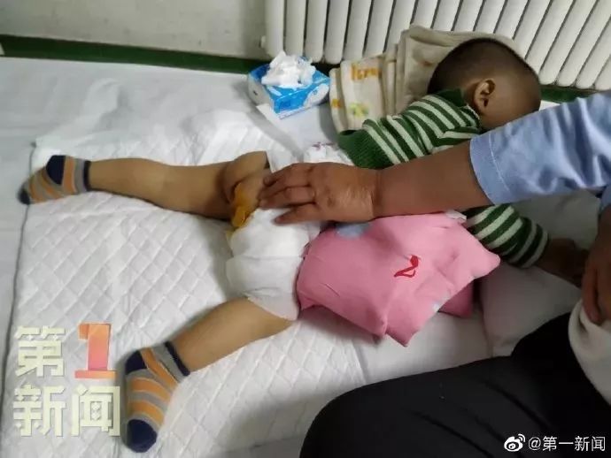                     宝宝玩滑梯成二度烫伤 小区附近这5个地方一定要警惕！
