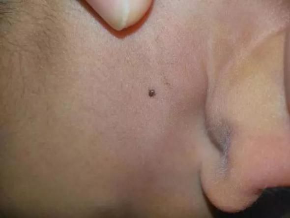                    每年都有孩子因它死亡！不知道这些虫子的可怕，别急着带娃出门