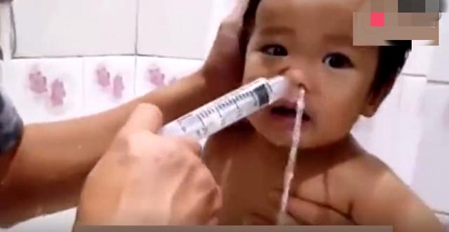                     原创            宝宝鼻塞流鼻涕？比打针吃药更好的方法是这个
