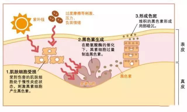 按年龄分组的人口死亡率呈现钟形分布