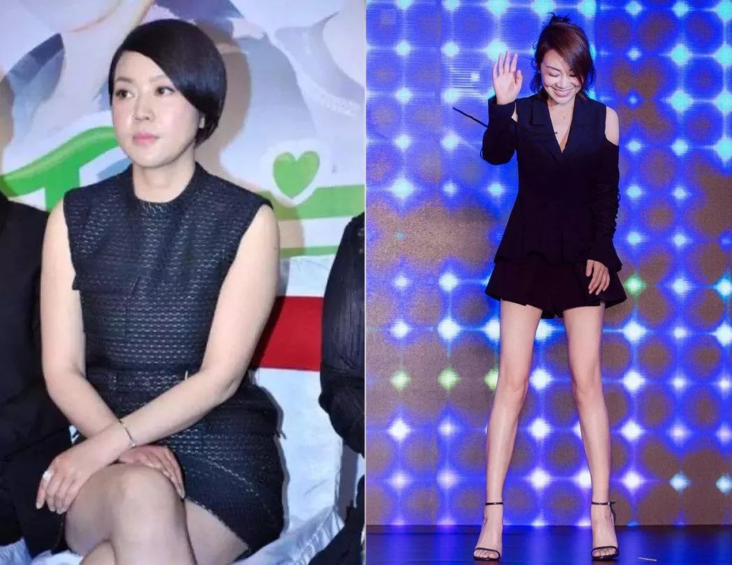连一直被嘲"万年小粗腿"的吴昕,瘦腿后都能时尚代言接到手软