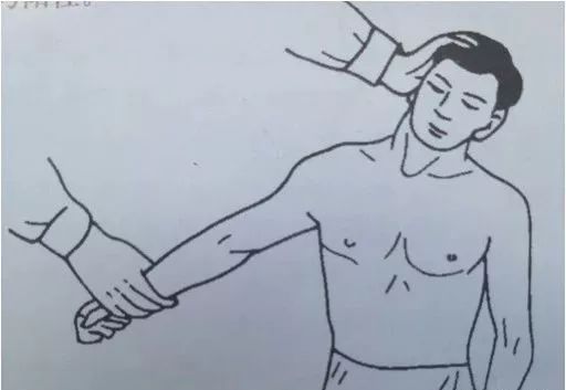 方向牵拉，患肢出现疼痛、麻木则为阳性。提示臂丛神经可能有受压情况。颈部检查----椎间孔挤压试验患者