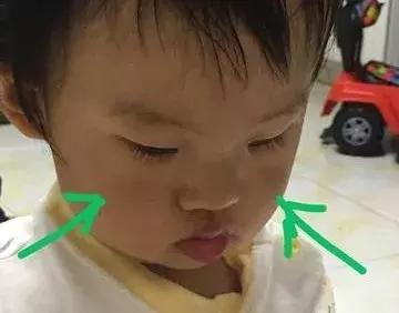                     育儿心经｜透过宝宝脸色看健康