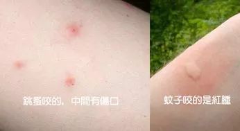                     每年都有孩子因它死亡！不知道这些虫子的可怕，别急着带娃出门