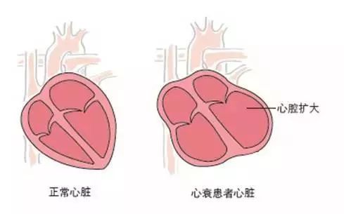 如何让心脏变大 f907a558972e4ca596dd4671ca951587.jpeg