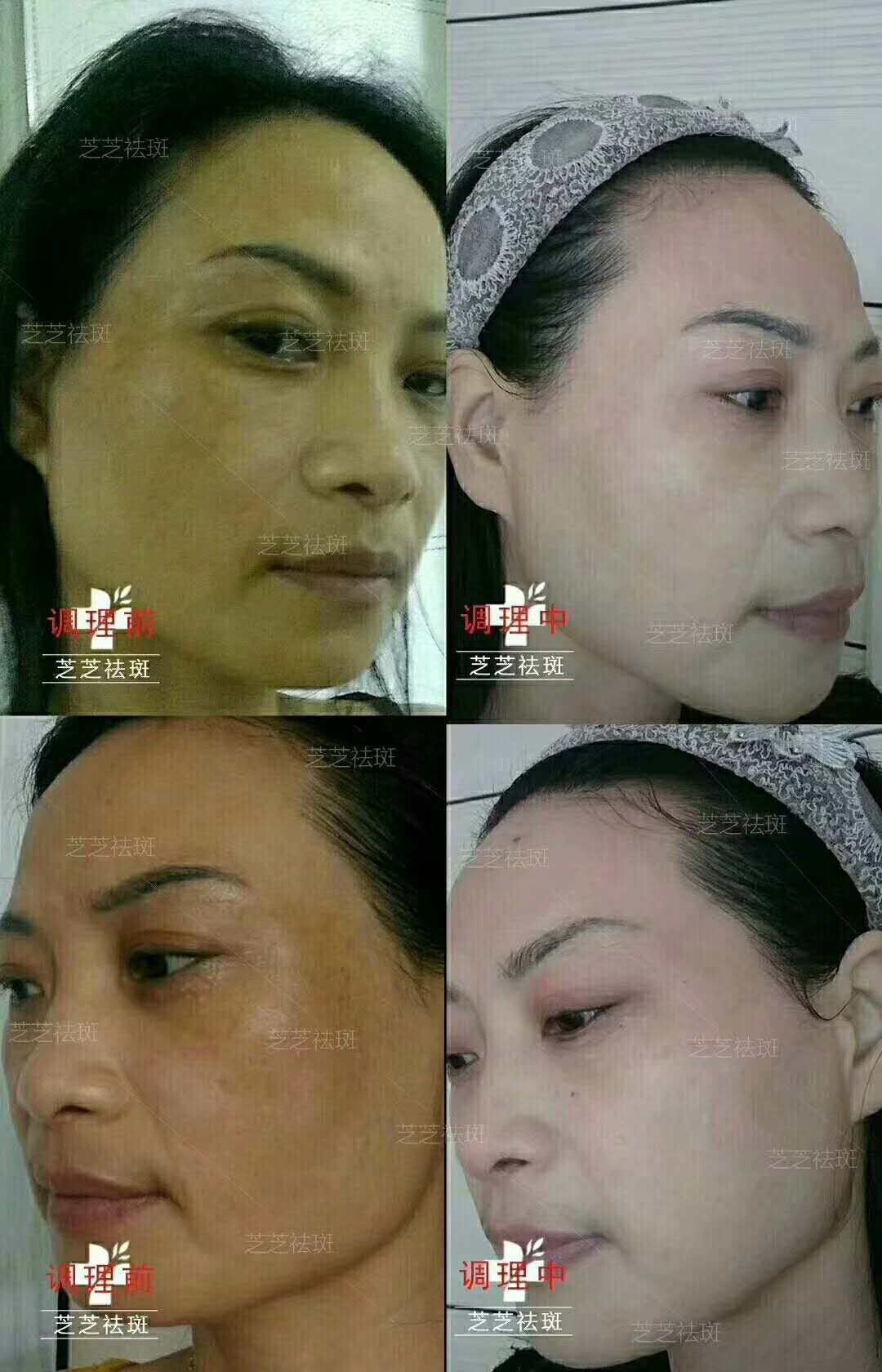 "黄脸婆"逆袭!终极方法只有这一个!