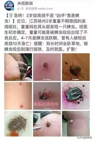                     “夺命蜱虫”再出没！河南已有3名宝宝被叮咬、钻进体内
