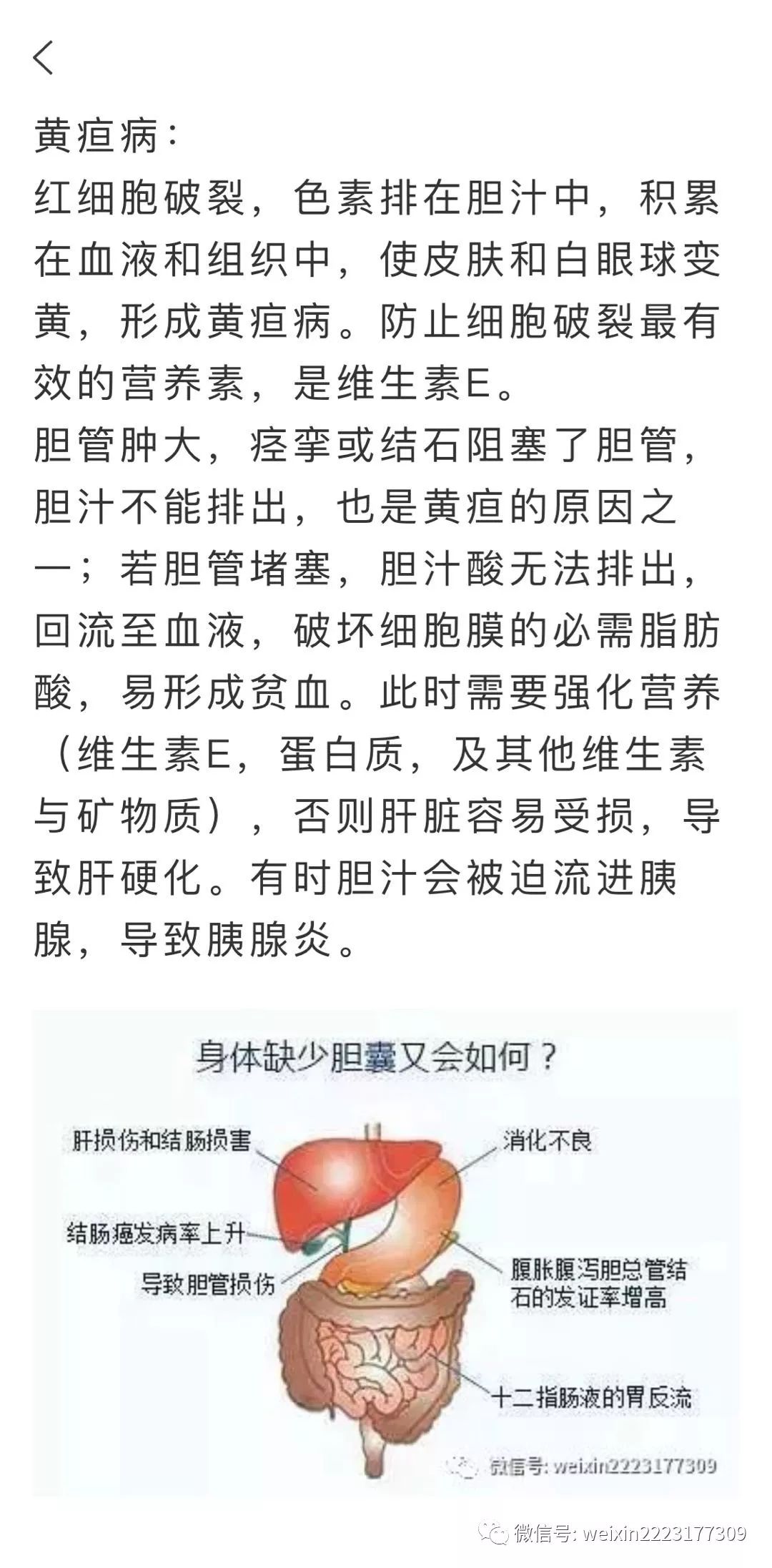 胆结石与胆囊炎问题的深度解析营养干预